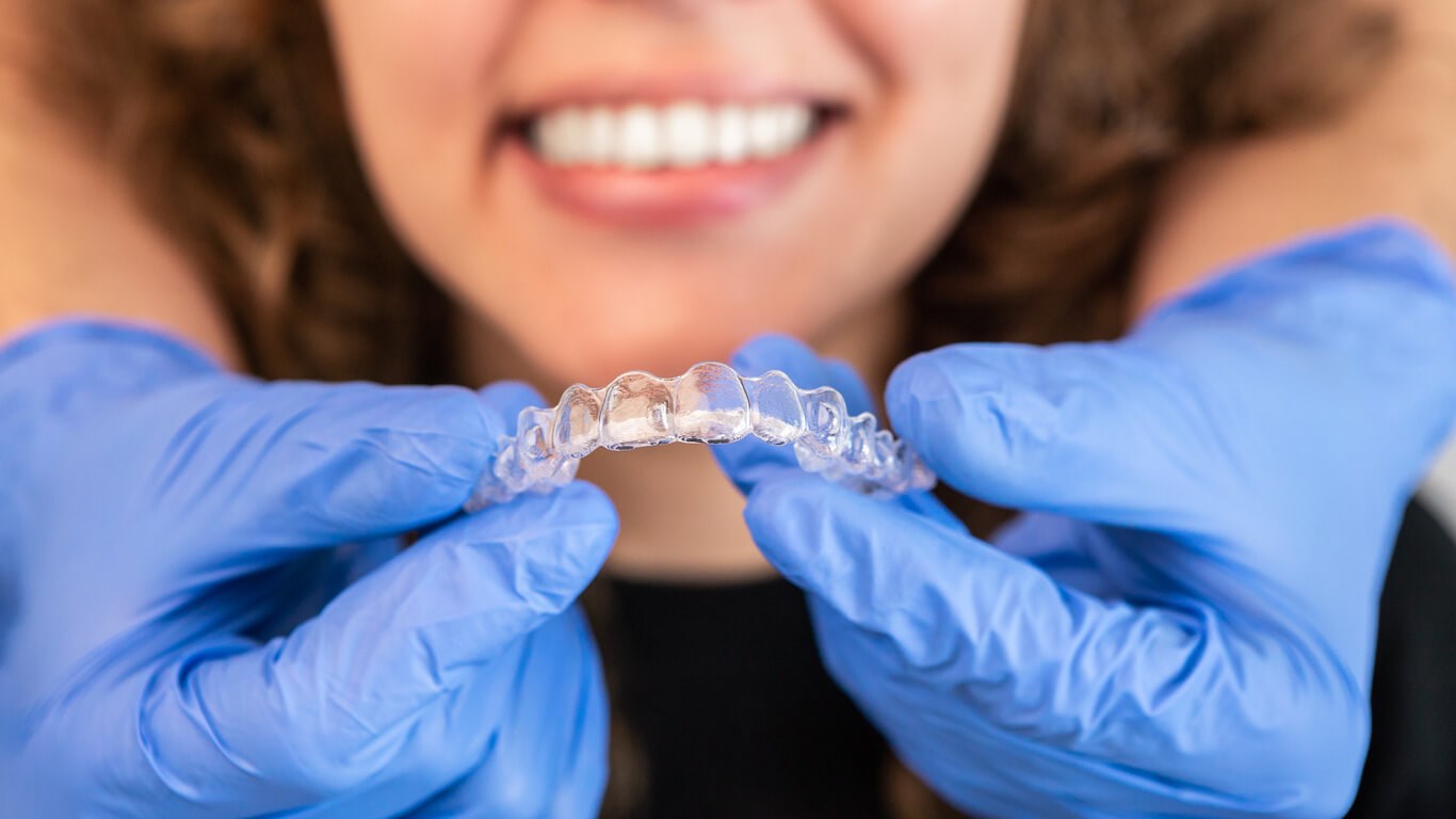 Clear Aligners